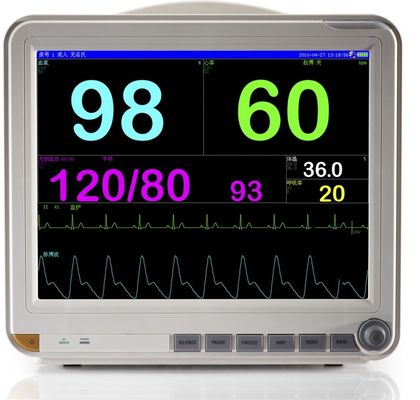 15-Zoll-tragbarer Multi-Parameter Patientenmonitor mit ECG, RESP, NIBP, Temperatur, Stunde