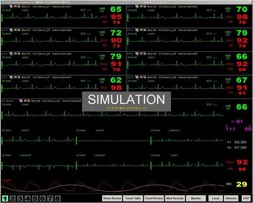 zentrale Überwachungsanlage tragbaren Kopfende Patientenmonitors